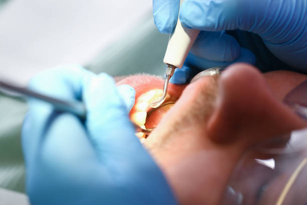 Best Emergency Wisdom Teeth Removal in , VA